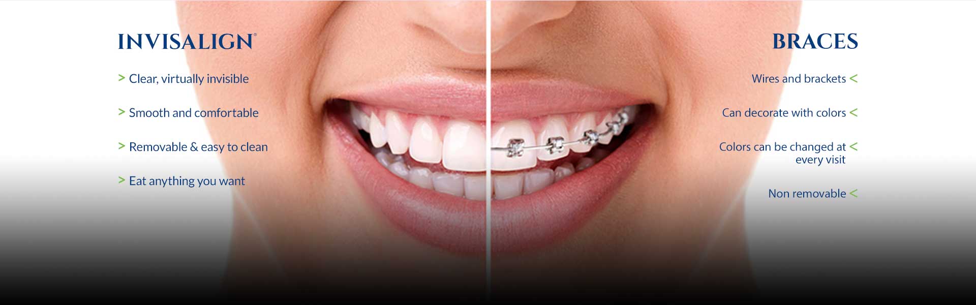 Orthodontist Ringgold GA Invisalign Braces Flanagan Orthodontics
