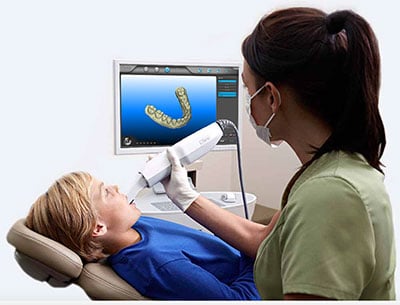 Intraoral-Scanning-Photo